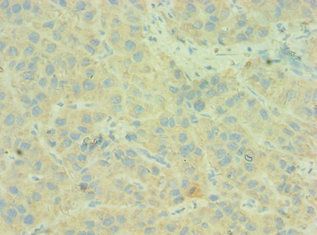 C4BPB Antibody