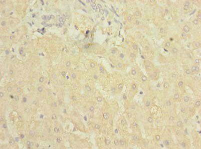 C5 Antibody