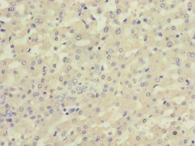 C5 Antibody