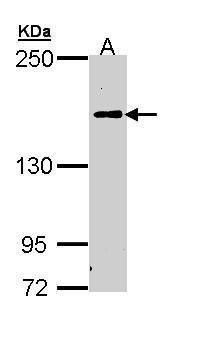 C5/C5b Rabbit Polyclonal Antibody