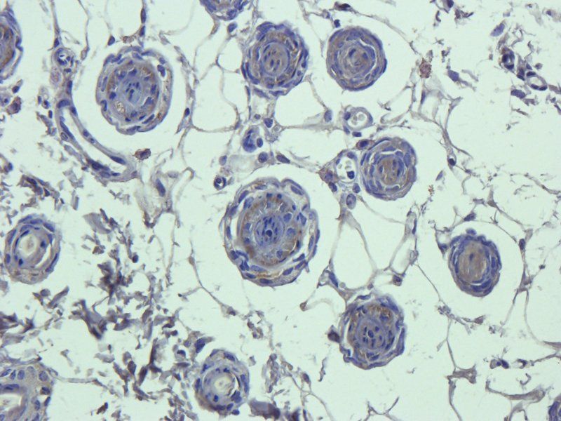 C5a Rabbit Polyclonal Antibody