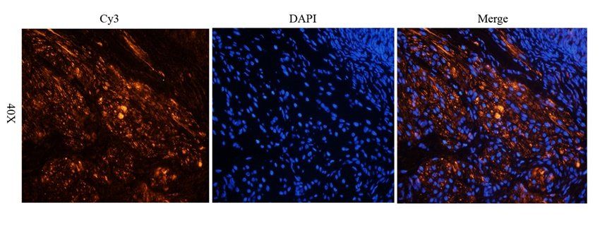 C5b-9 antibody