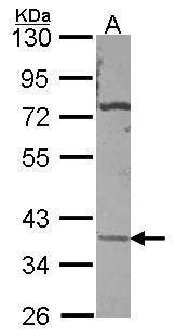 Sodium/Potassium ATPase beta 3 Rabbit Polyclonal Antibody