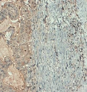 CA19-9 Monoclonal Antibody