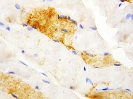 Carbonic Anhydrase III/CA3 Rabbit Polyclonal Antibody