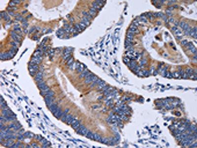 CA4 Antibody