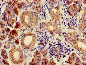 CA6 Antibody