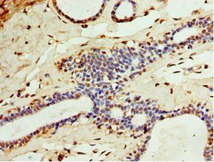 CA8 Antibody