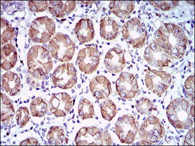 CA9 Antibody