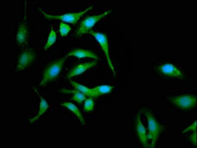 CABP4 Antibody