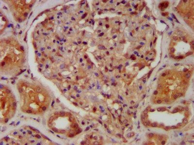 CABP4 Antibody