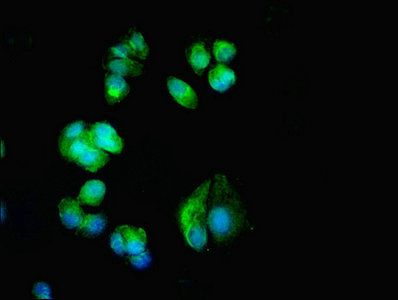 CACNA1H Antibody