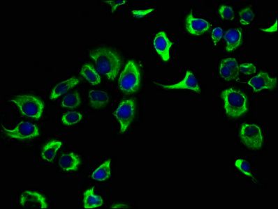 CACNA1H Antibody