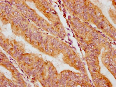 CACNA1H Antibody