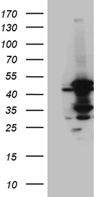 CACNB1 Antibody