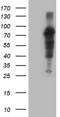 CACNB1 Antibody