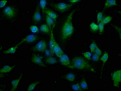 CALB1 Antibody