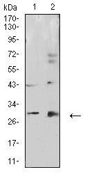 CALB2 Antibody