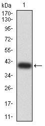CALB2 Antibody