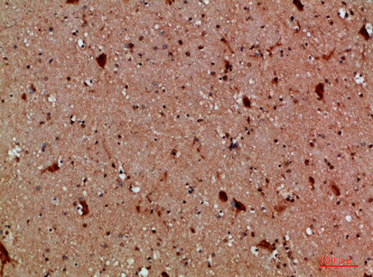 CALB2 Antibody