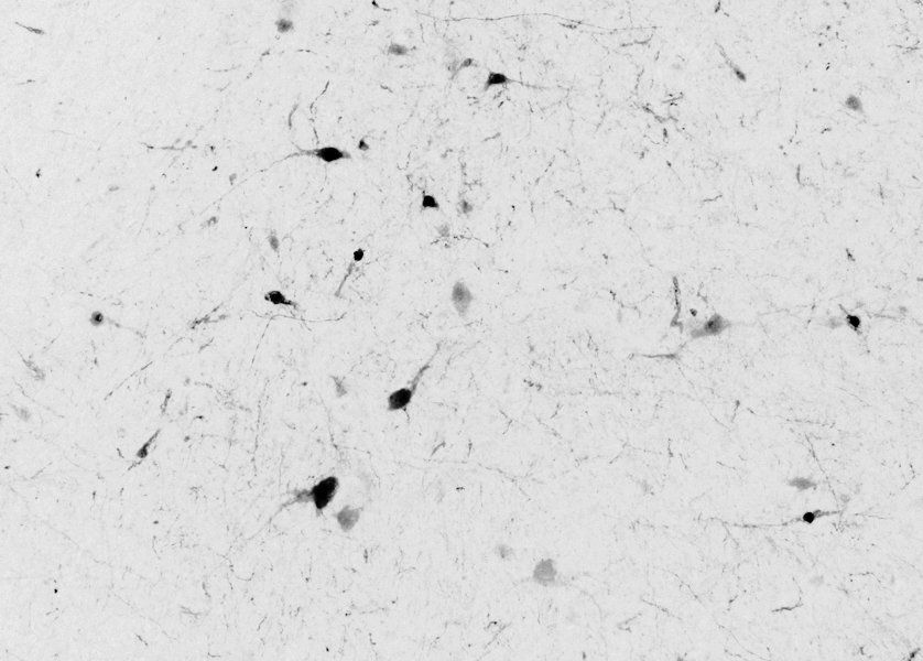 calbindin D28 Antibody