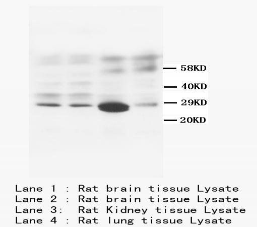 Anti-Calbindin-D Calb1 Antibody (Monoclonal, CB-955)