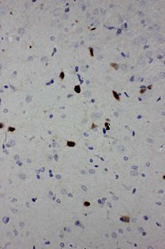Anti-Calbindin-D Calb1 Antibody (Monoclonal, CB-955)