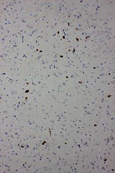 Anti-Calbindin-D Calb1 Antibody (Monoclonal, CB-955)