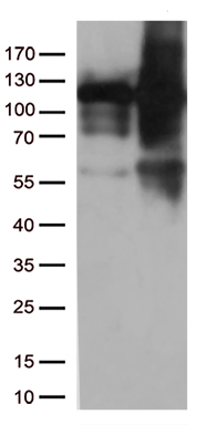 RCAN1 Antibody