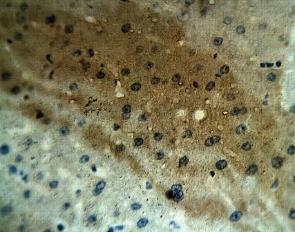Rabbit anti Human Calcium Homeostasis Modulator Protein 1 Antibody