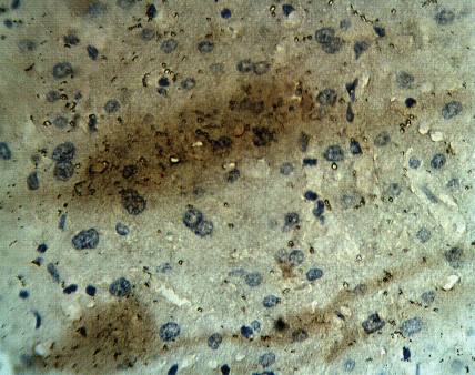 Rabbit anti Human Calcium Homeostasis Modulator Protein 1 Antibody