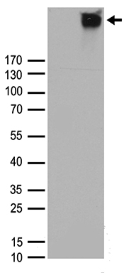 Calcium Sensing Receptor Antibody
