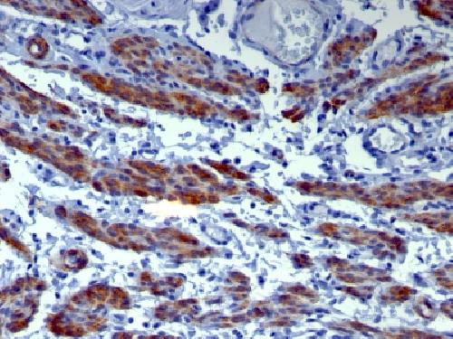 CALD1 Antibody