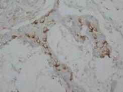 Calretinin/CALB2 Rabbit Polyclonal Antibody
