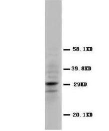 Calretinin/CALB2 Rabbit Polyclonal Antibody