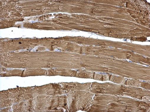 Calsequestrin 2 Rabbit Polyclonal Antibody