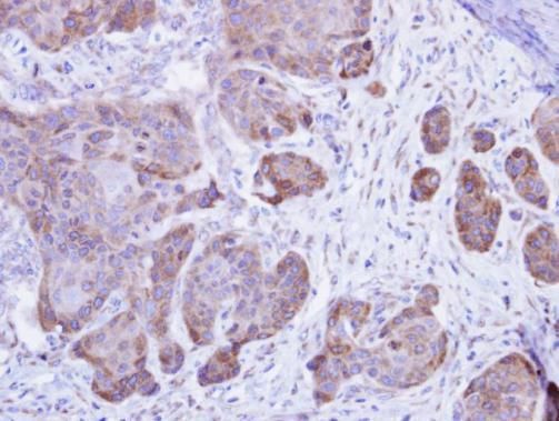 Calsequestrin 2 Rabbit Polyclonal Antibody