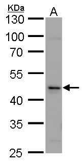Calsequestrin 2 Rabbit Polyclonal Antibody