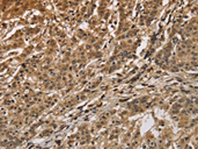 CALU Antibody