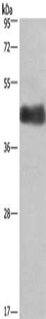 CALU Antibody