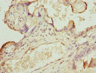 CAMK1D Antibody