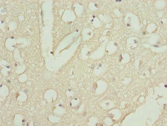 CAMK1D Antibody
