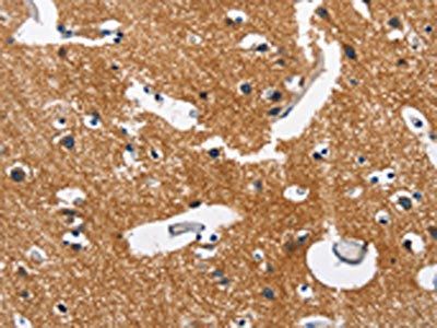 CAMK1D Antibody