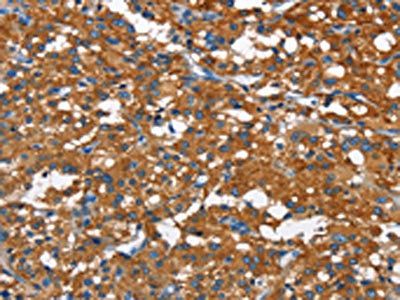 CAMK1D Antibody