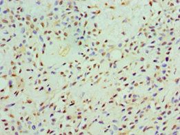 CAMK1G Antibody