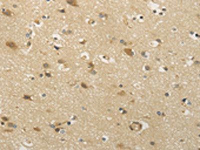 CAMK1G Antibody