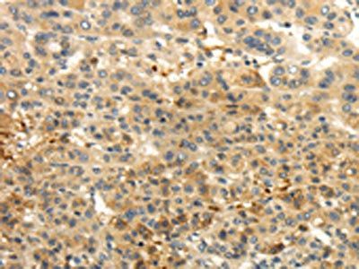 CAMK1G Antibody