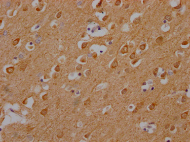 CAMK2A Antibody