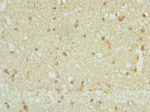 CAMK2B Antibody