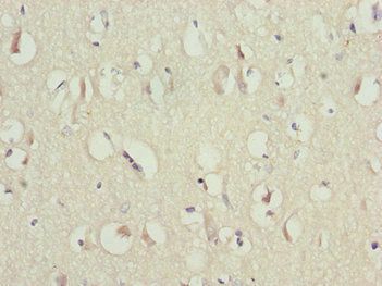 CAMK2D Antibody